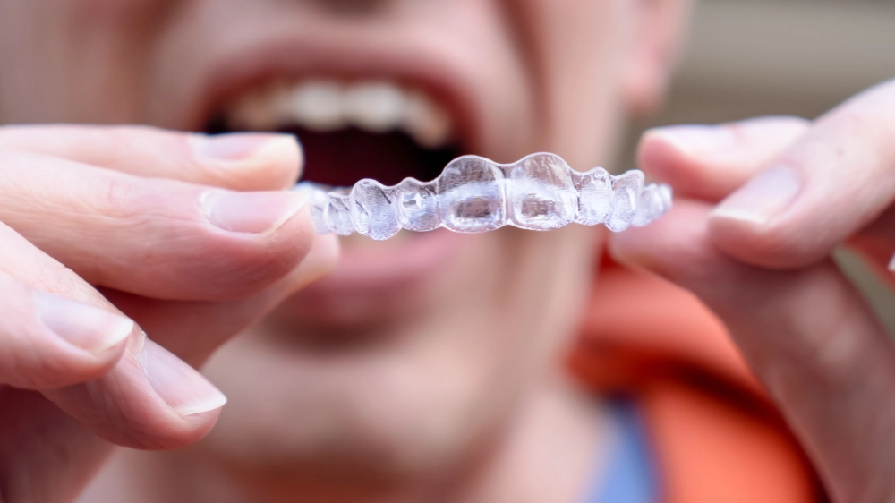 A person holds a clear dental aligner with both hands, close to their open mouth, emphasizing orthodontic care. The tone is clinical and focused.