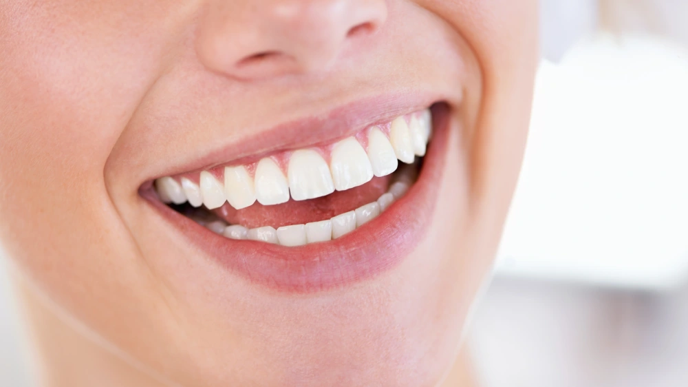 Is Teeth Whitening Safe